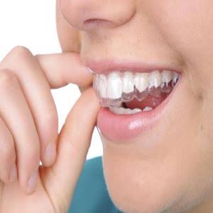 Orthodontics Upper East Side